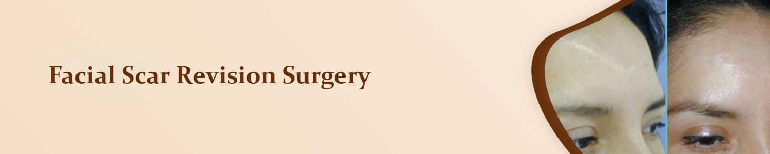 Facial-Scar-Revision-Surgery